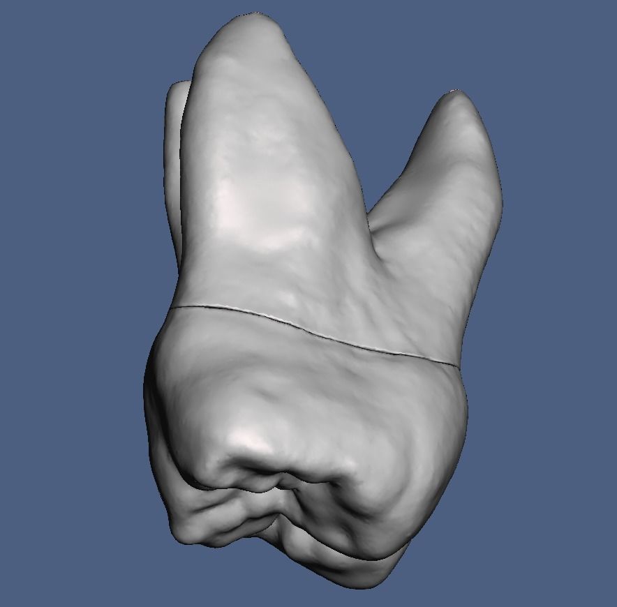 Natural anatomy teeth with root canal in 2 pieces  3D print model_16