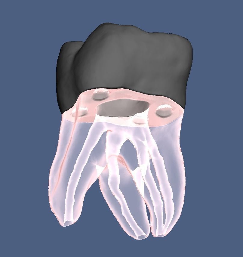 Natural anatomy teeth with root canal in 2 pieces  3D print model_14