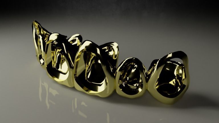  Grillz - gold teeth 3D model_1