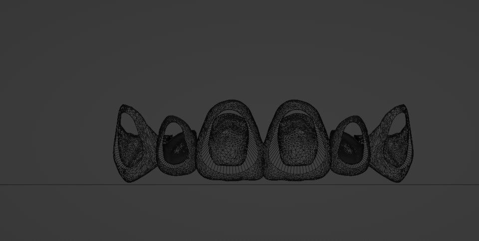  Grillz - gold teeth 3D model_5