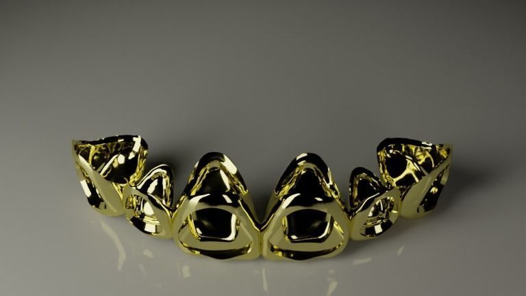  Grillz - gold teeth 3D model_3
