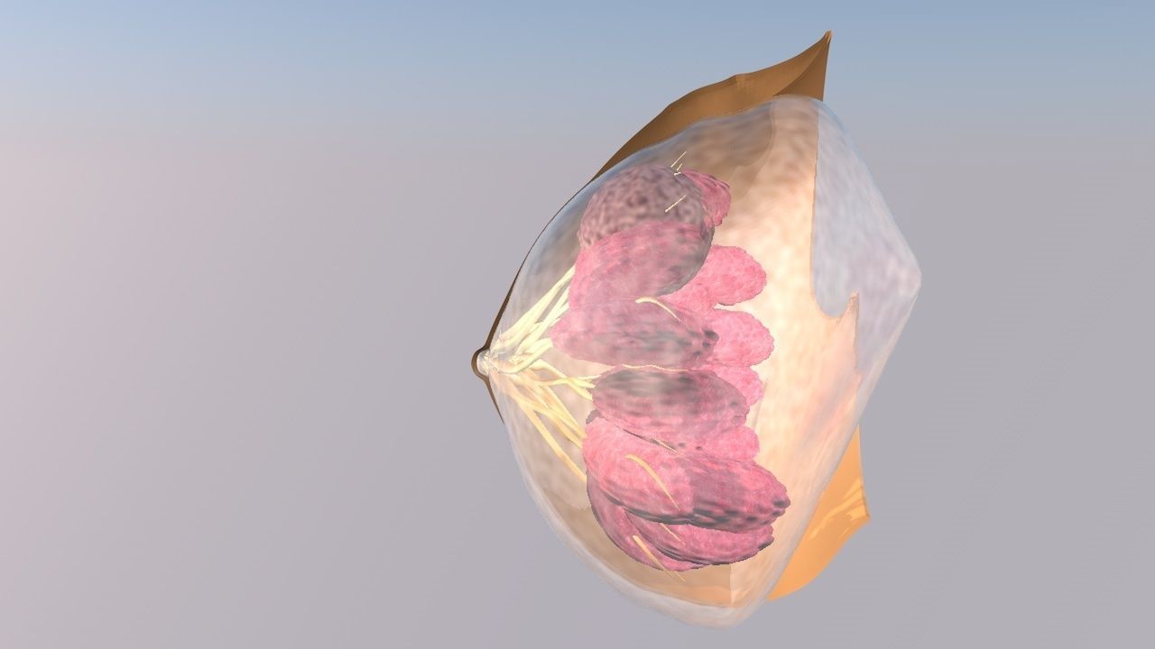 Breast with cancer cell animated 3D model_1