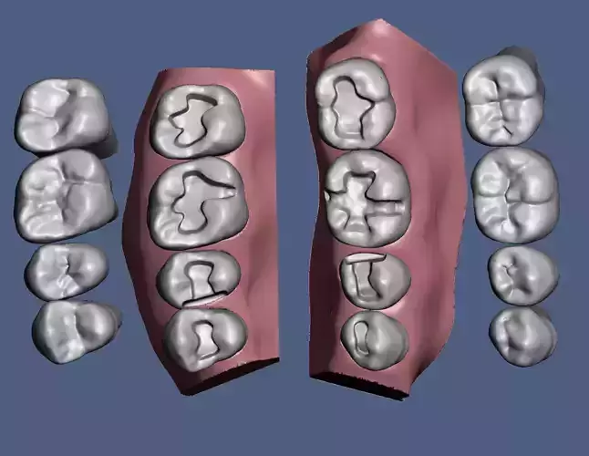 D004  Dental anatomy model Inlay Composite practice 3D print model