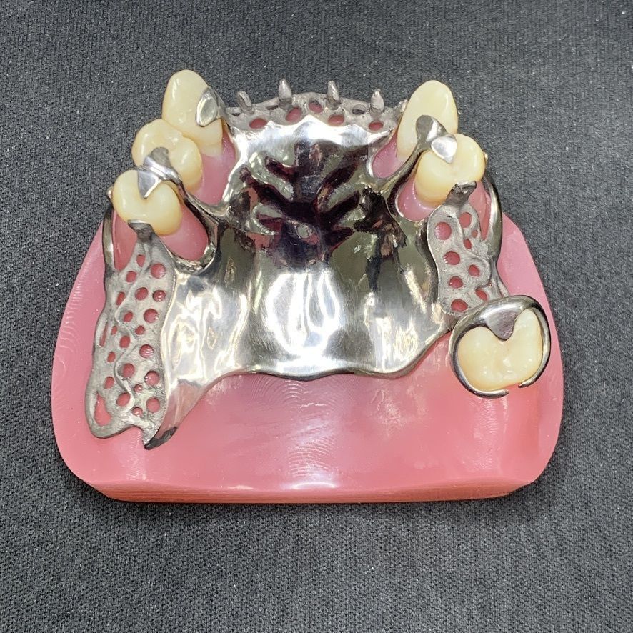 Metal framework RPD design 3D model 3D printable | CGTrader