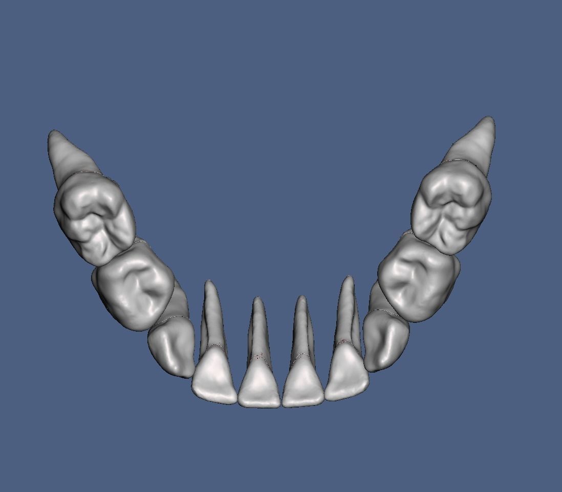Primary teeth anatomy model with root canal  for separate print 3D print model_6