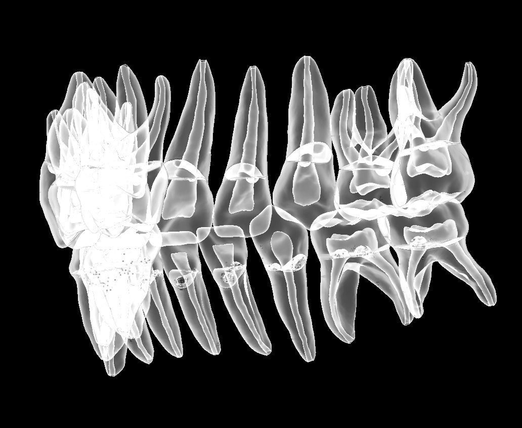 Primary teeth anatomy model with root canal  for separate print 3D print model_3