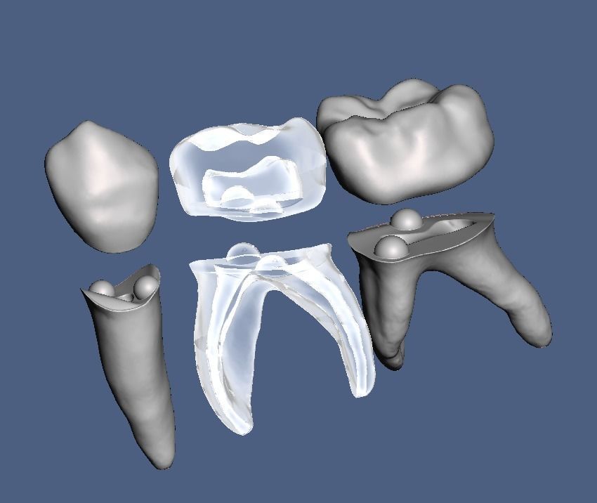 Primary teeth anatomy model with root canal  for separate print 3D print model_2