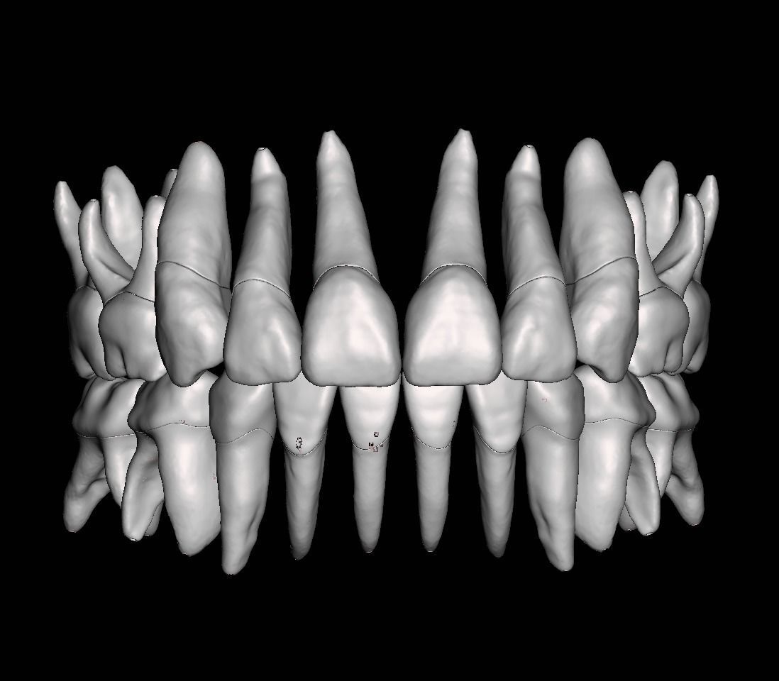 Primary teeth anatomy model with root canal  for separate print 3D print model_5