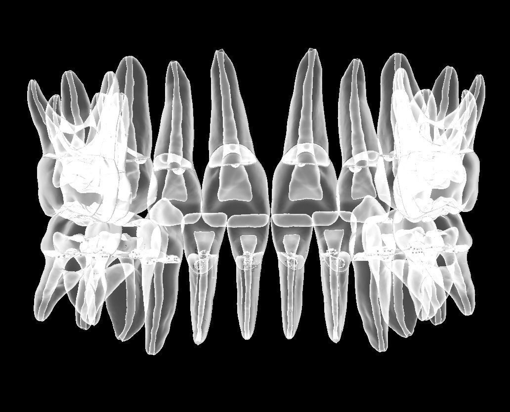Primary teeth anatomy model with root canal  for separate print 3D print model_4