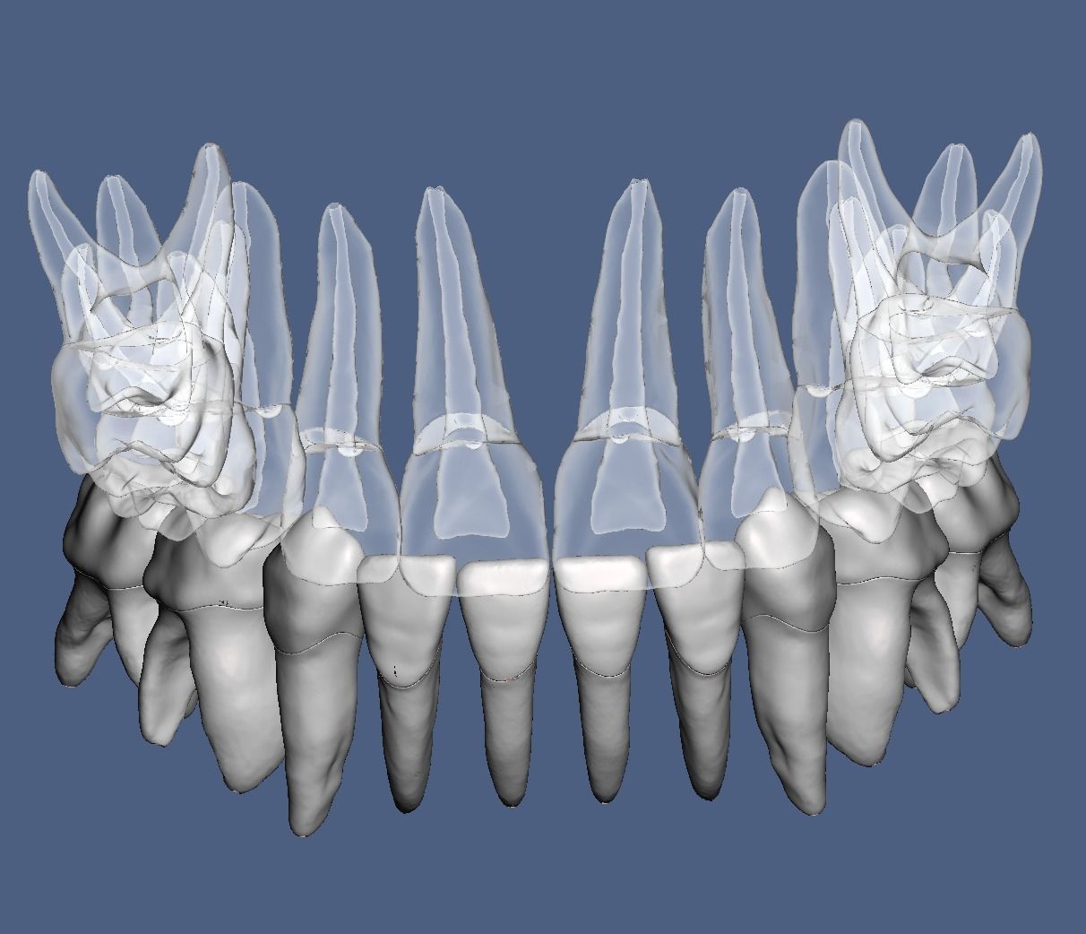 Primary teeth anatomy model with root canal  for separate print 3D print model_10