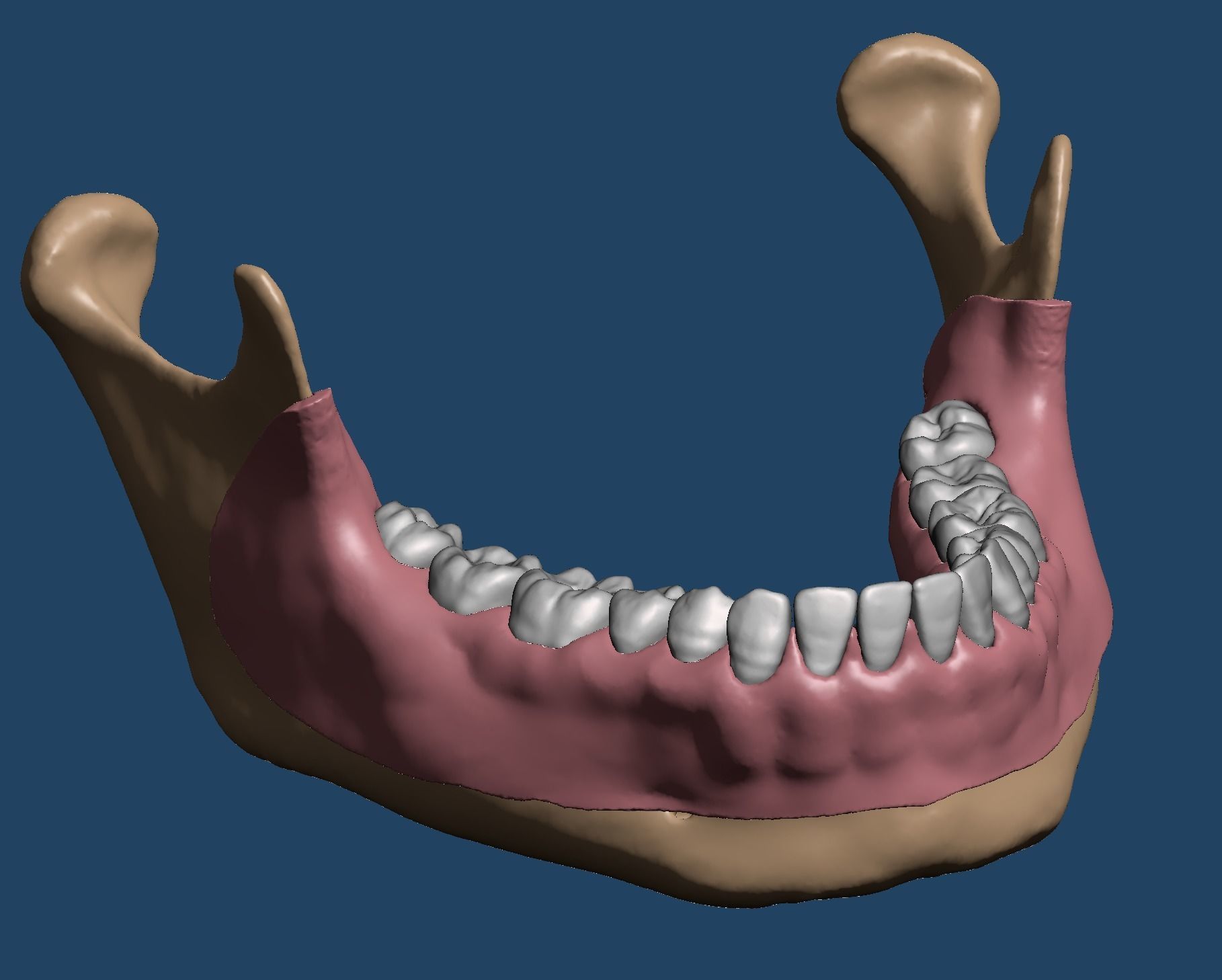 Maxillary and Mandibular dental model FULL SET 3D Model Collection_4