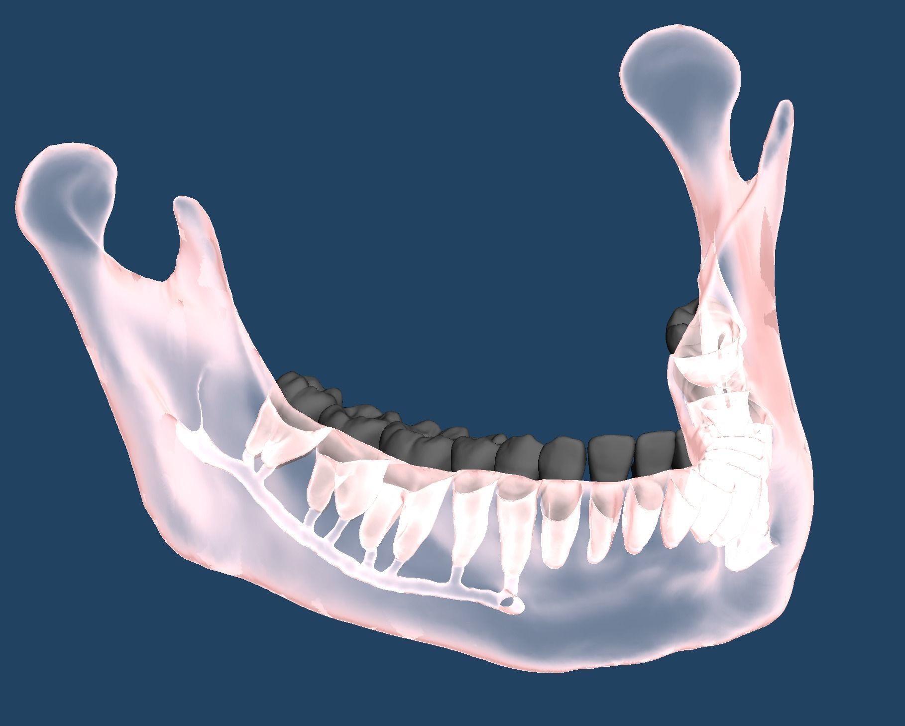 Maxillary and Mandibular dental model FULL SET 3D Model Collection_3