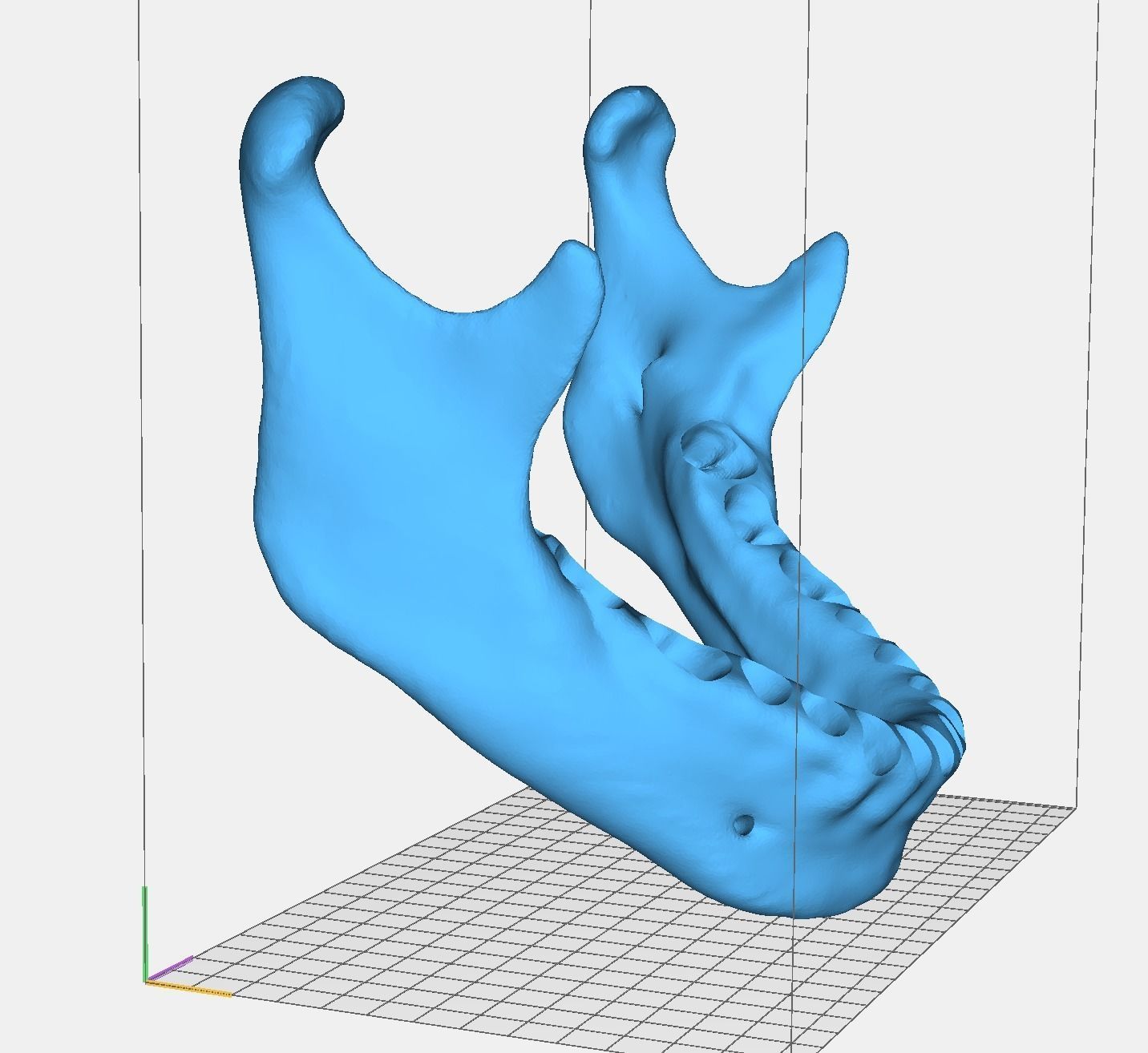 Maxillary and Mandibular dental model FULL SET 3D Model Collection_7