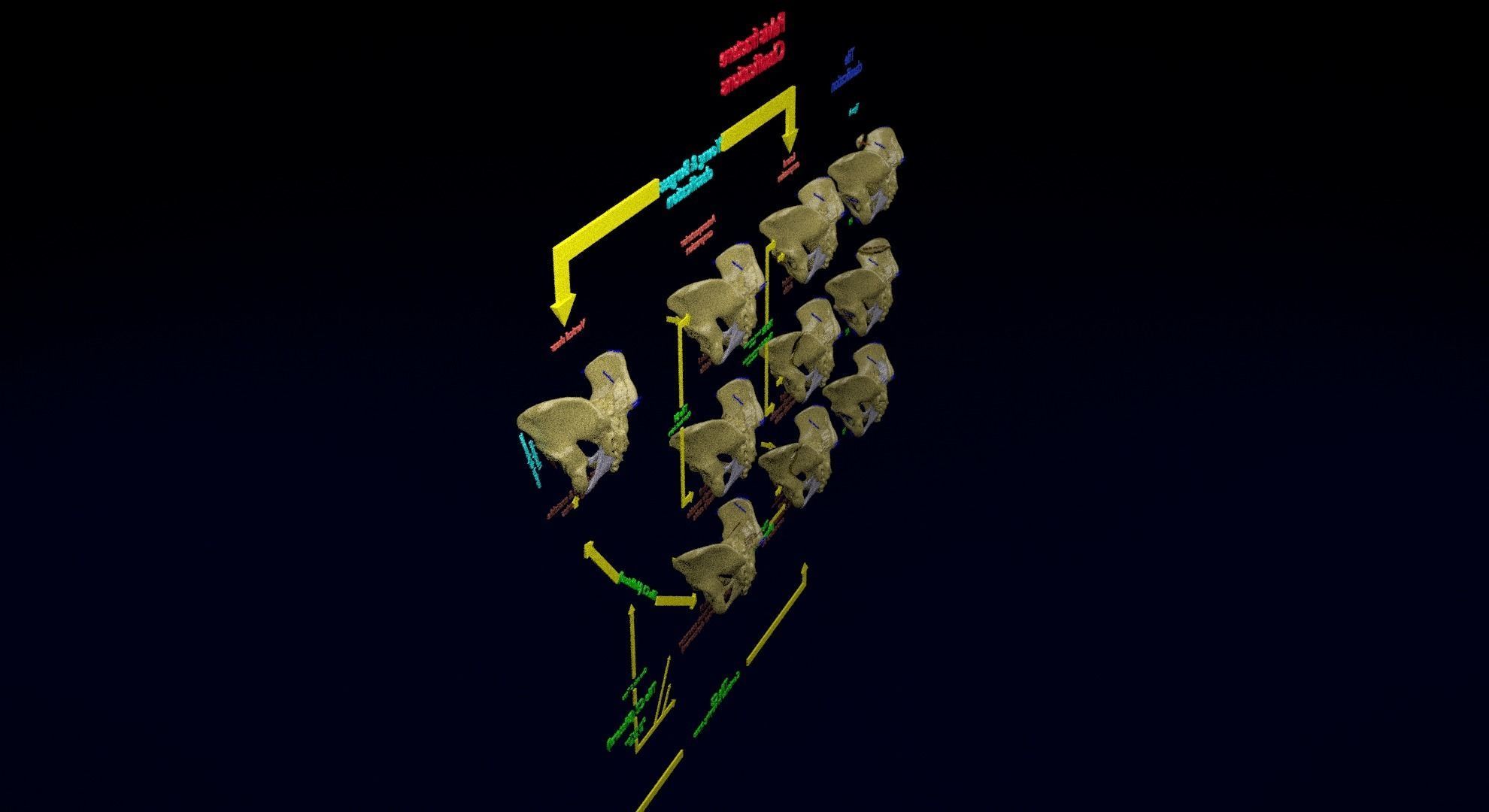 Pelvis fracture classifications 3D model_30