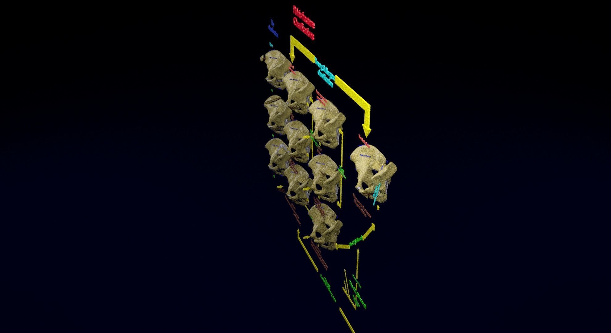 Pelvis fracture classifications 3D model_28