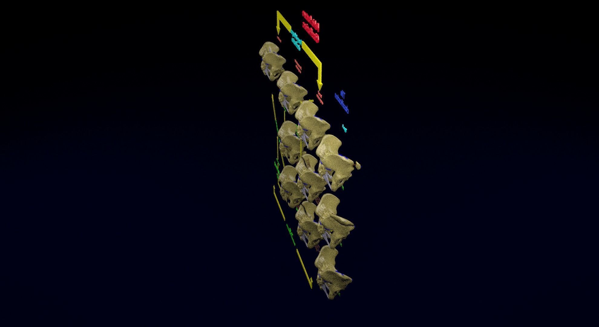 Pelvis fracture classifications 3D model_13