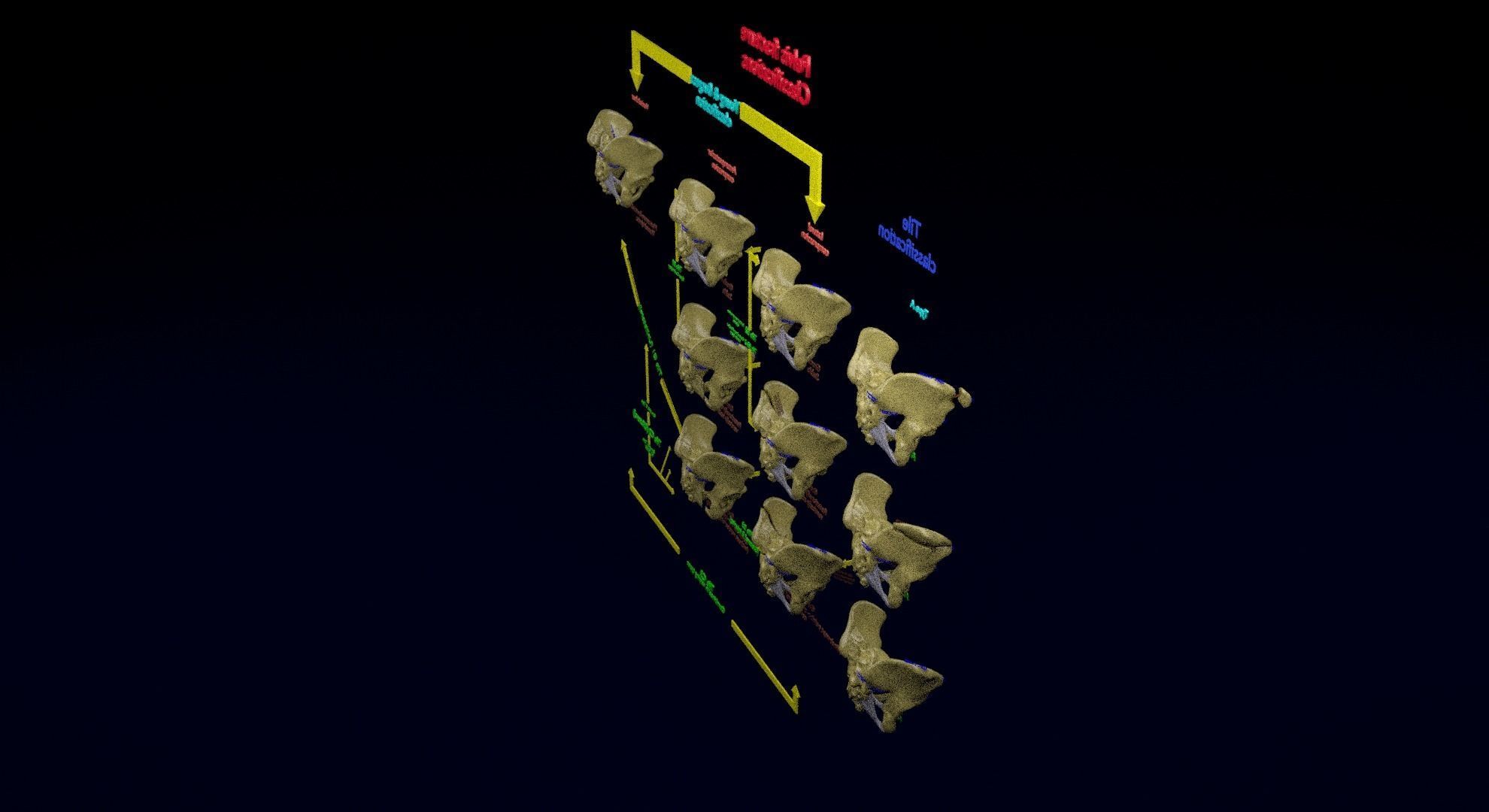 Pelvis fracture classifications 3D model_17