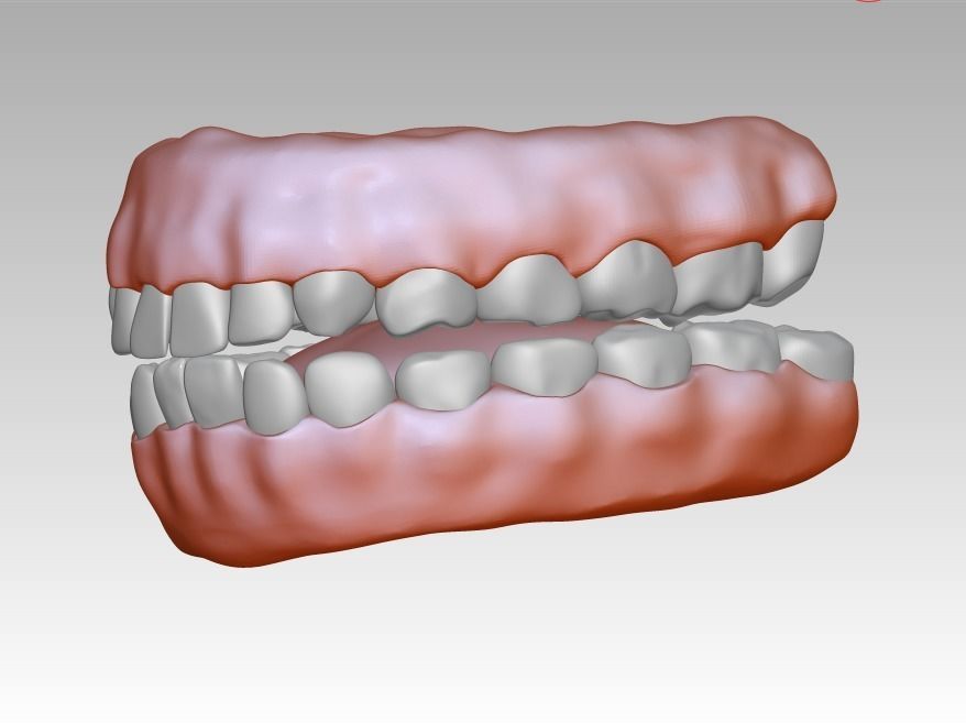 3D model download of dental gum 3D oral model 3D print model_2
