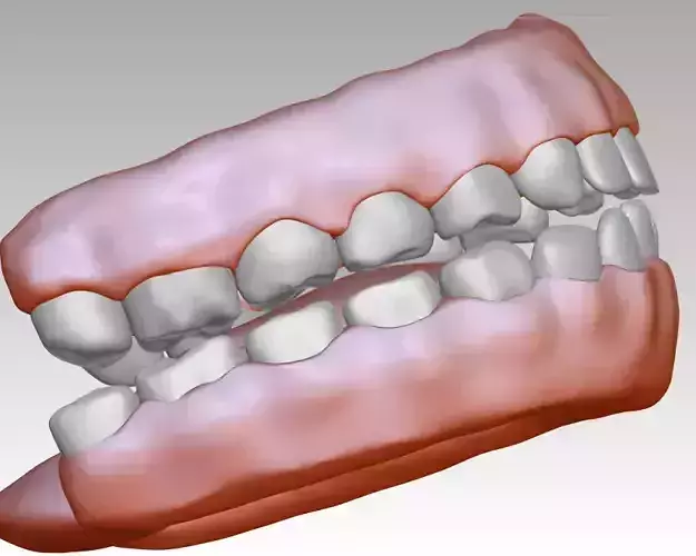 3D model download of dental gum 3D oral model