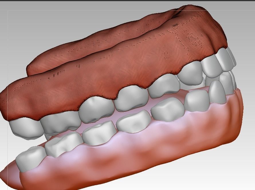 3D model download of dental gum 3D oral model 3D print model_3