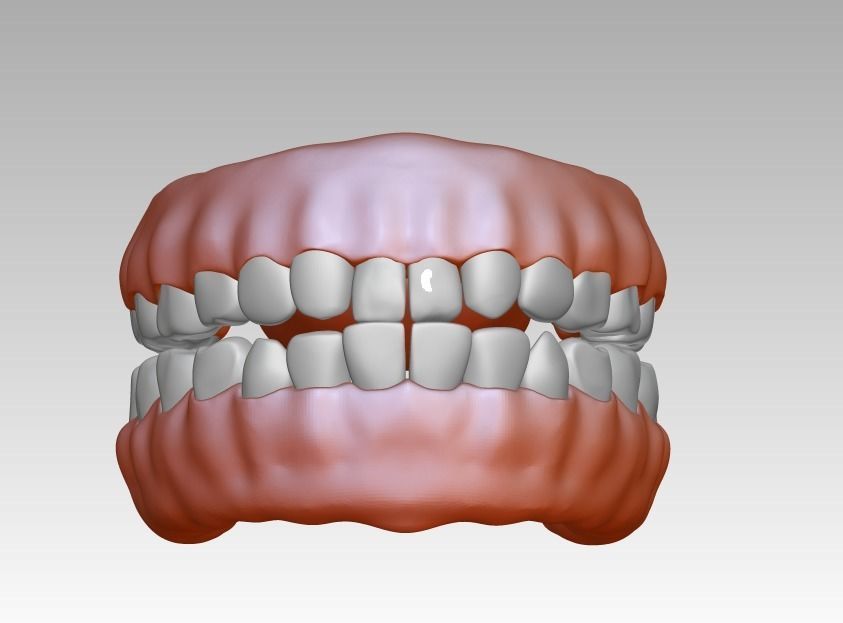 3D model download of dental gum 3D oral model 3D print model_7