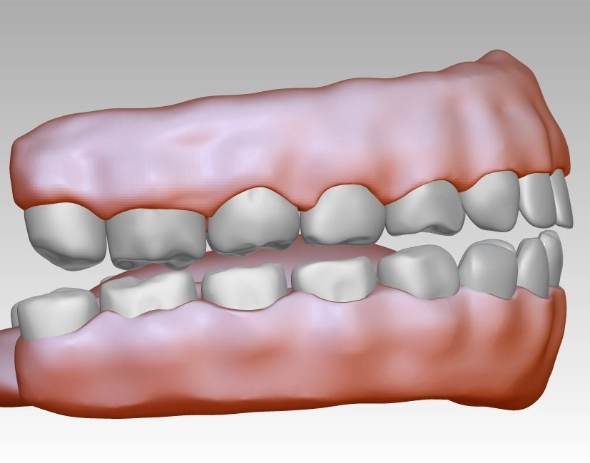 3D model download of dental gum 3D oral model 3D print model_6