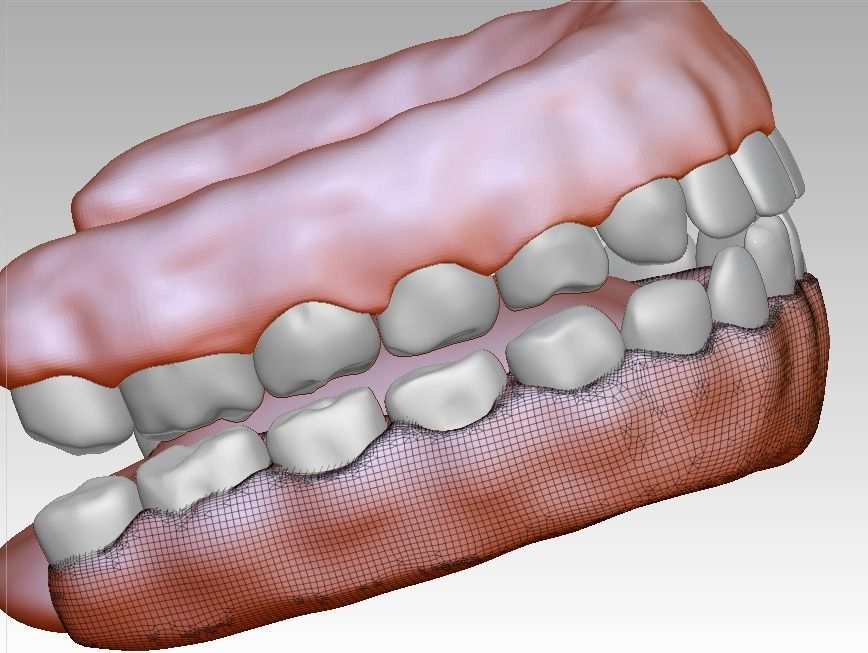 3D model download of dental gum 3D oral model 3D print model_4