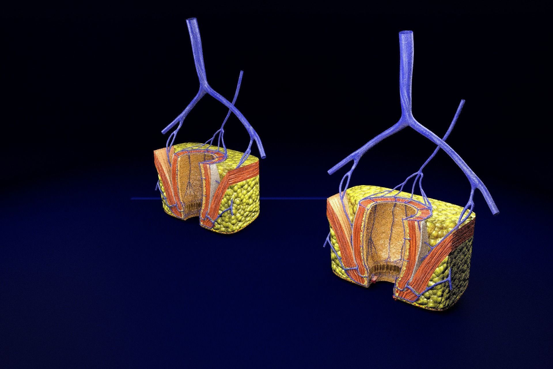 hemorrhoids piles 3D model_89