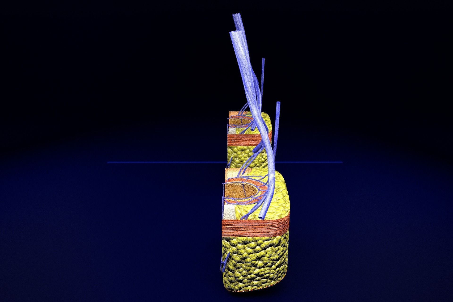 hemorrhoids piles 3D model_35