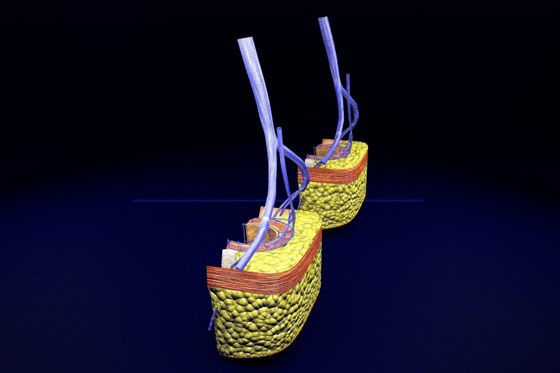 hemorrhoids piles 3D model_49
