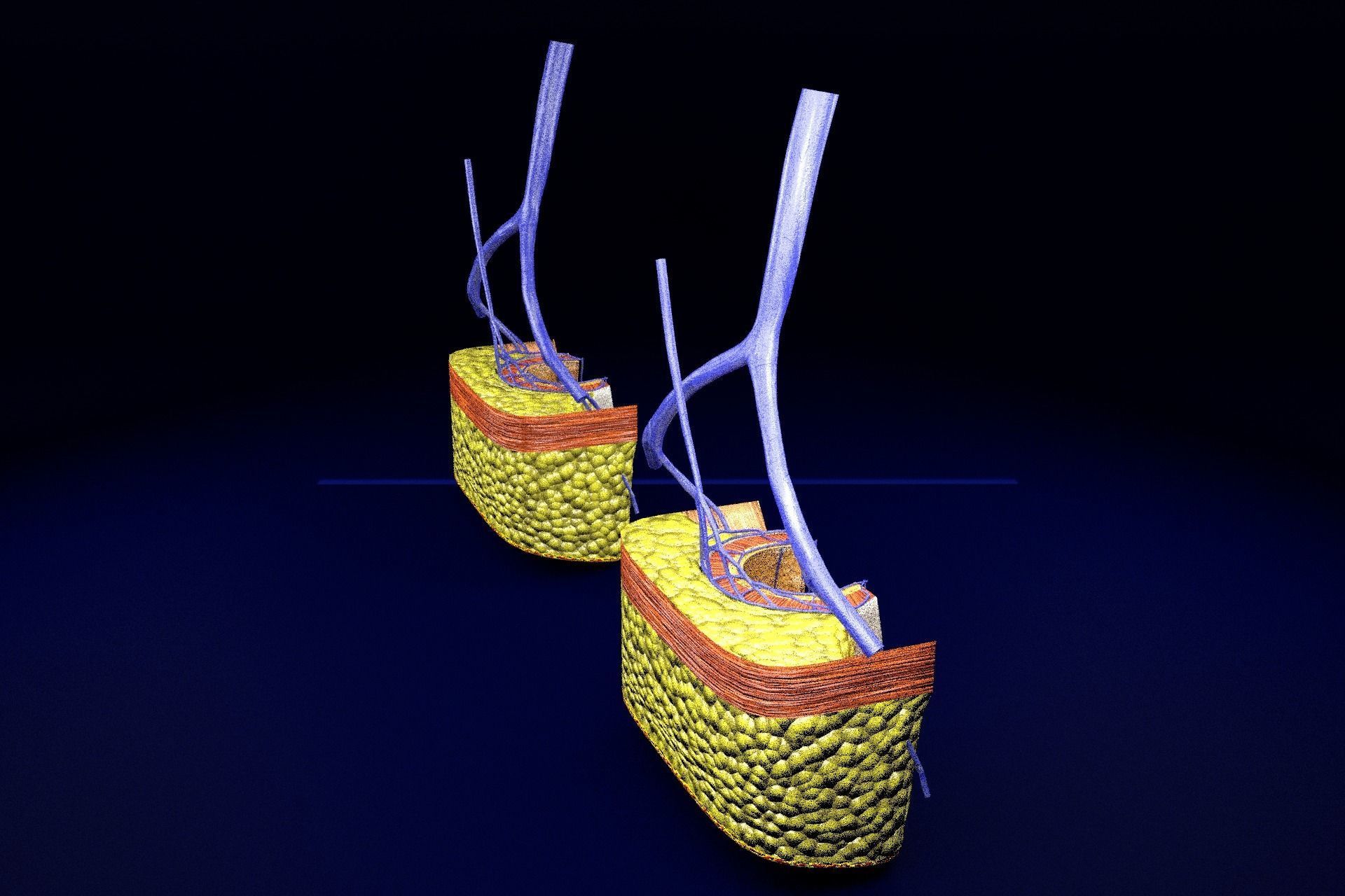 hemorrhoids piles 3D model_54