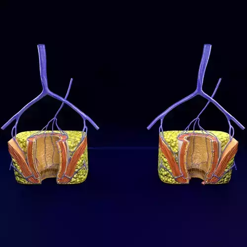 hemorrhoids piles 3D model