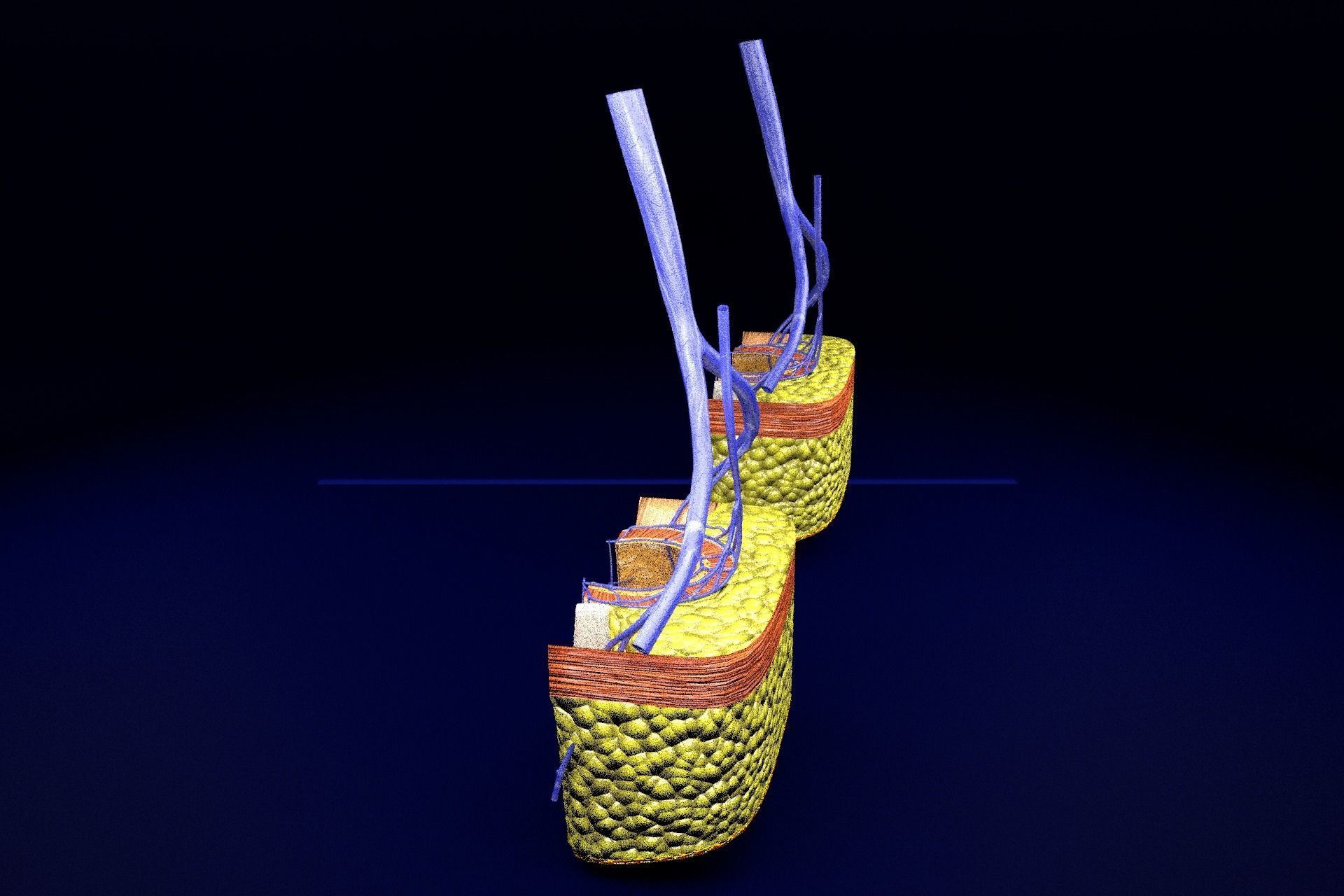 hemorrhoids piles 3D model_50
