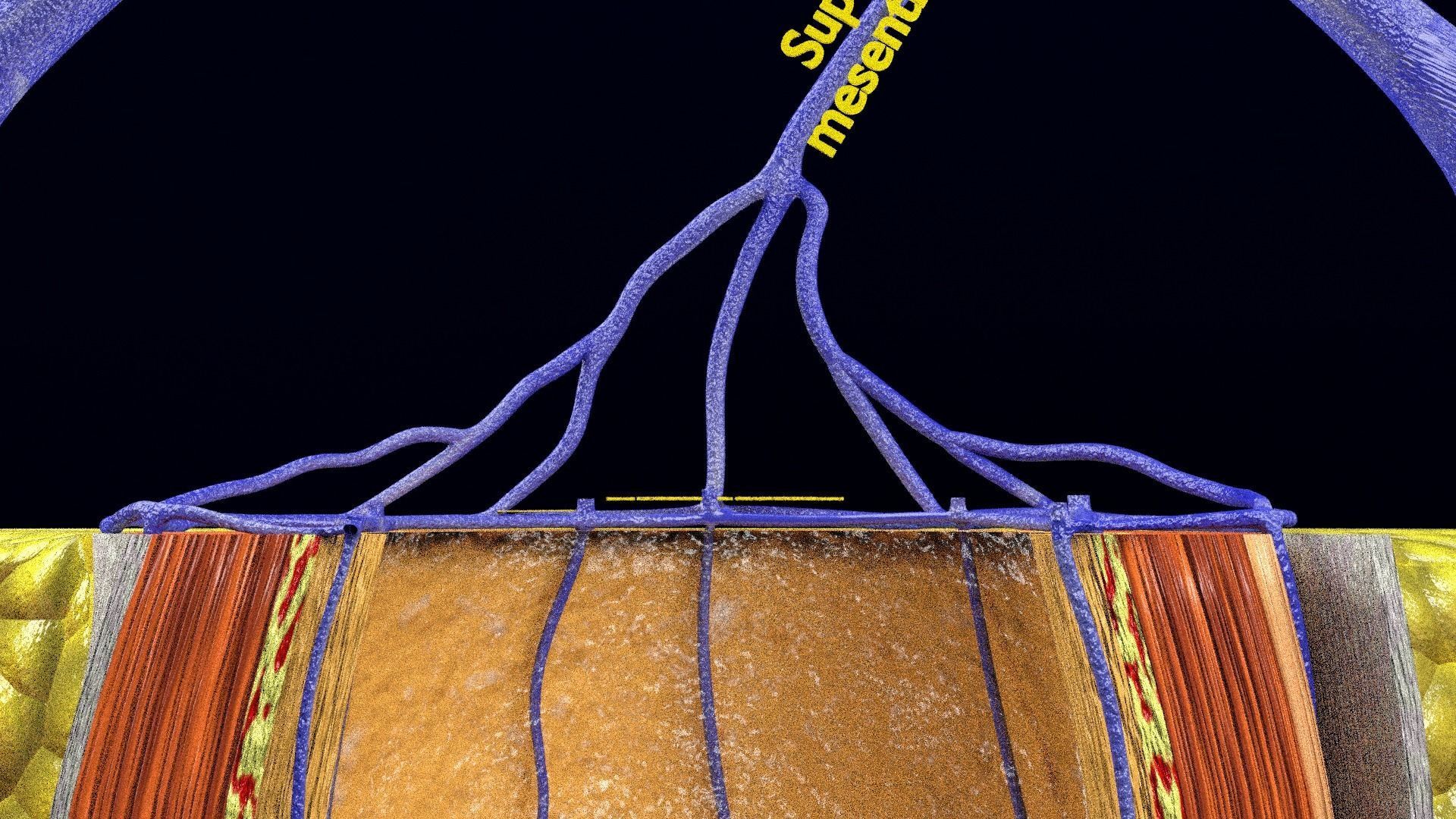 hemorrhoids piles 3D model_93