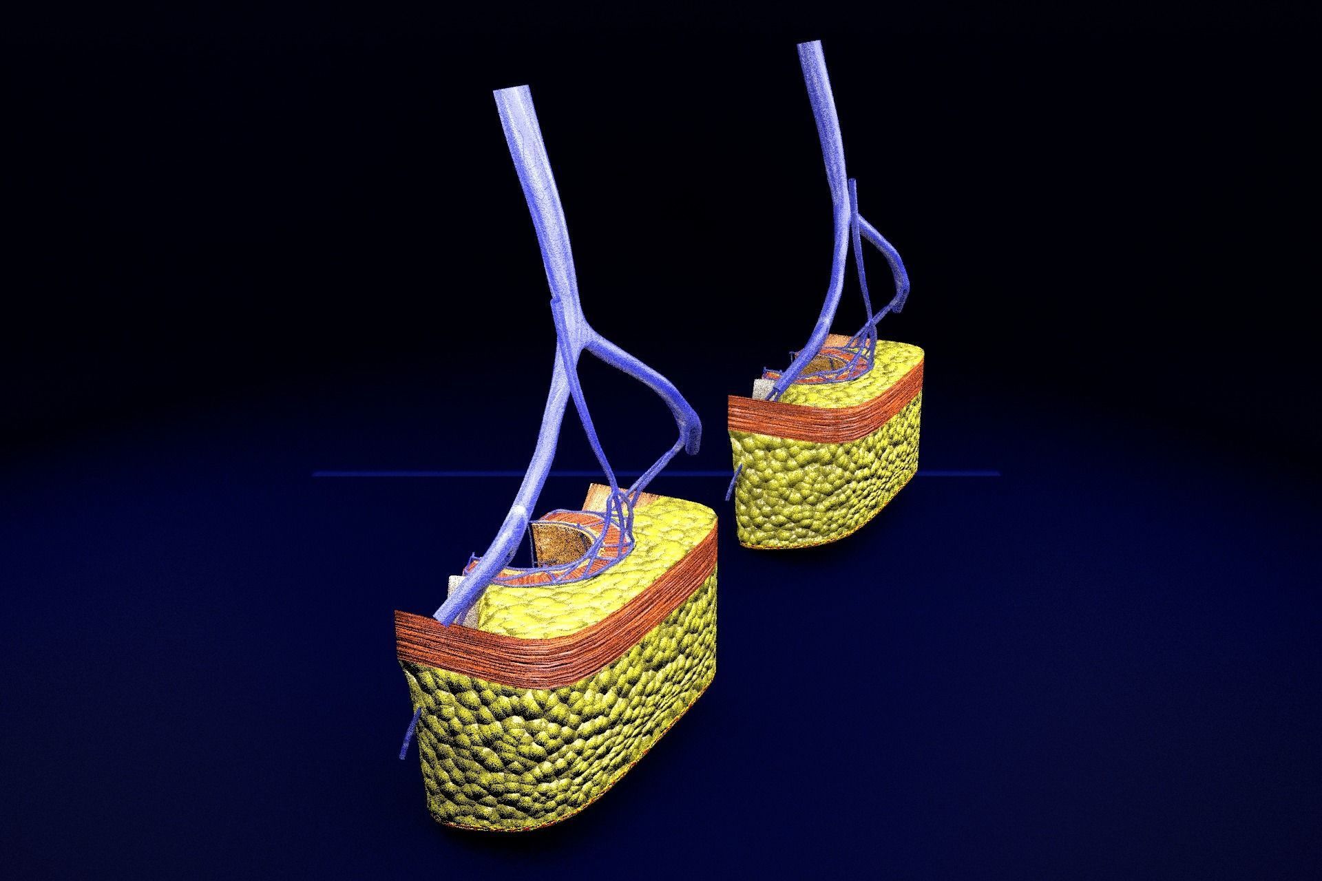 hemorrhoids piles 3D model_65