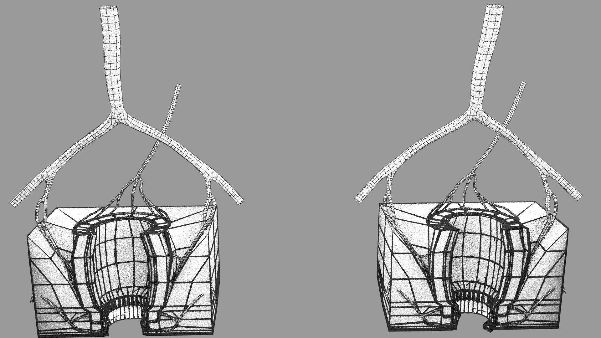 hemorrhoids piles 3D model_7