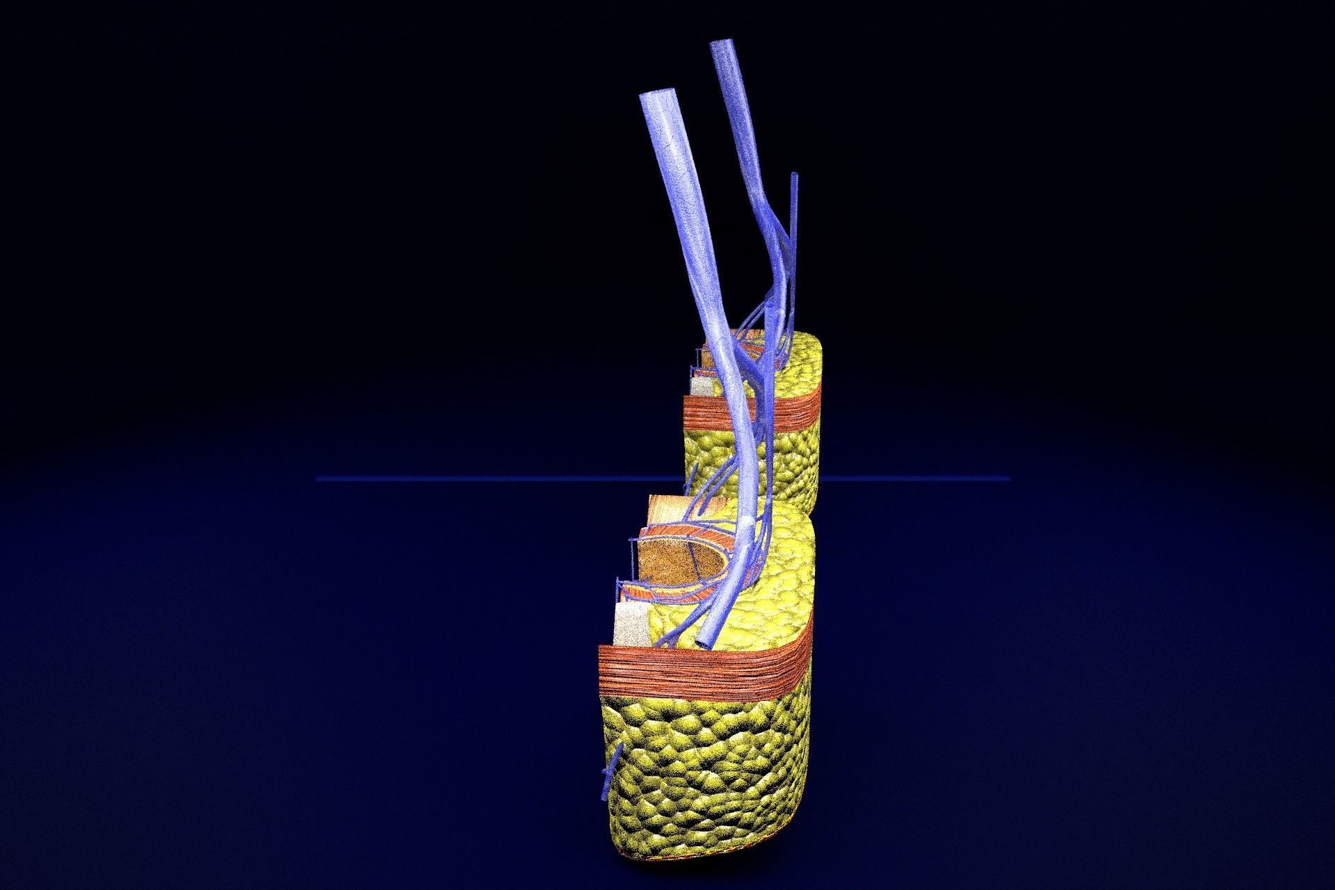 hemorrhoids piles 3D model_48