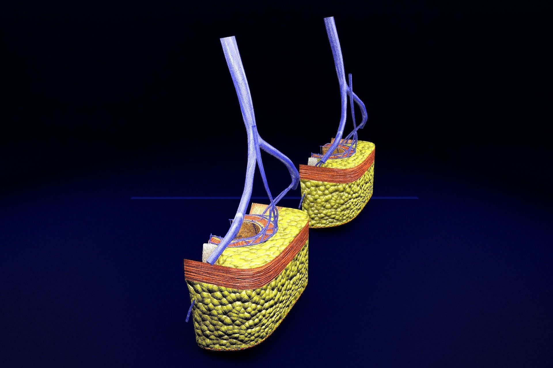 hemorrhoids piles 3D model_70