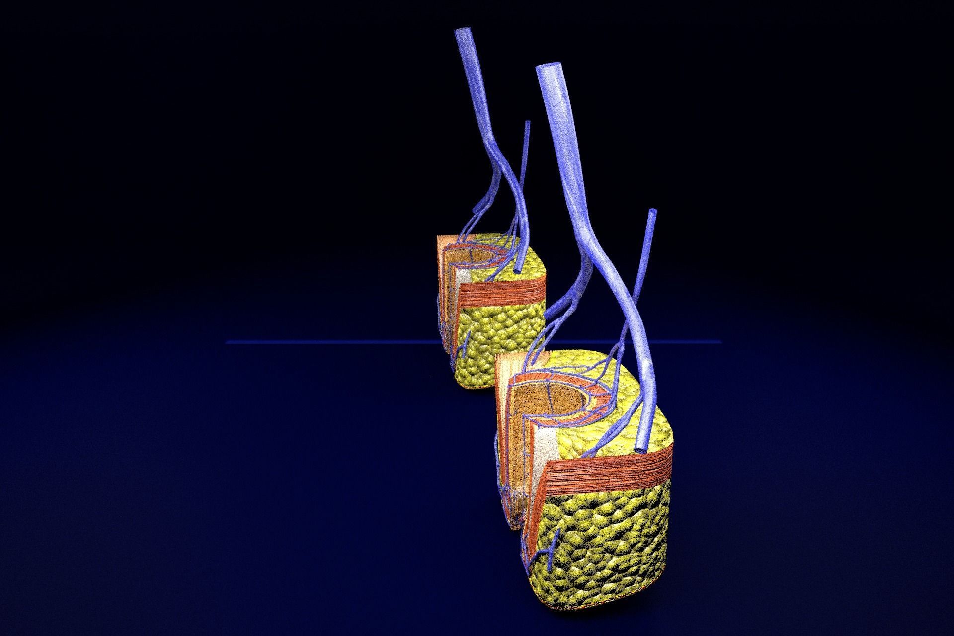 hemorrhoids piles 3D model_67