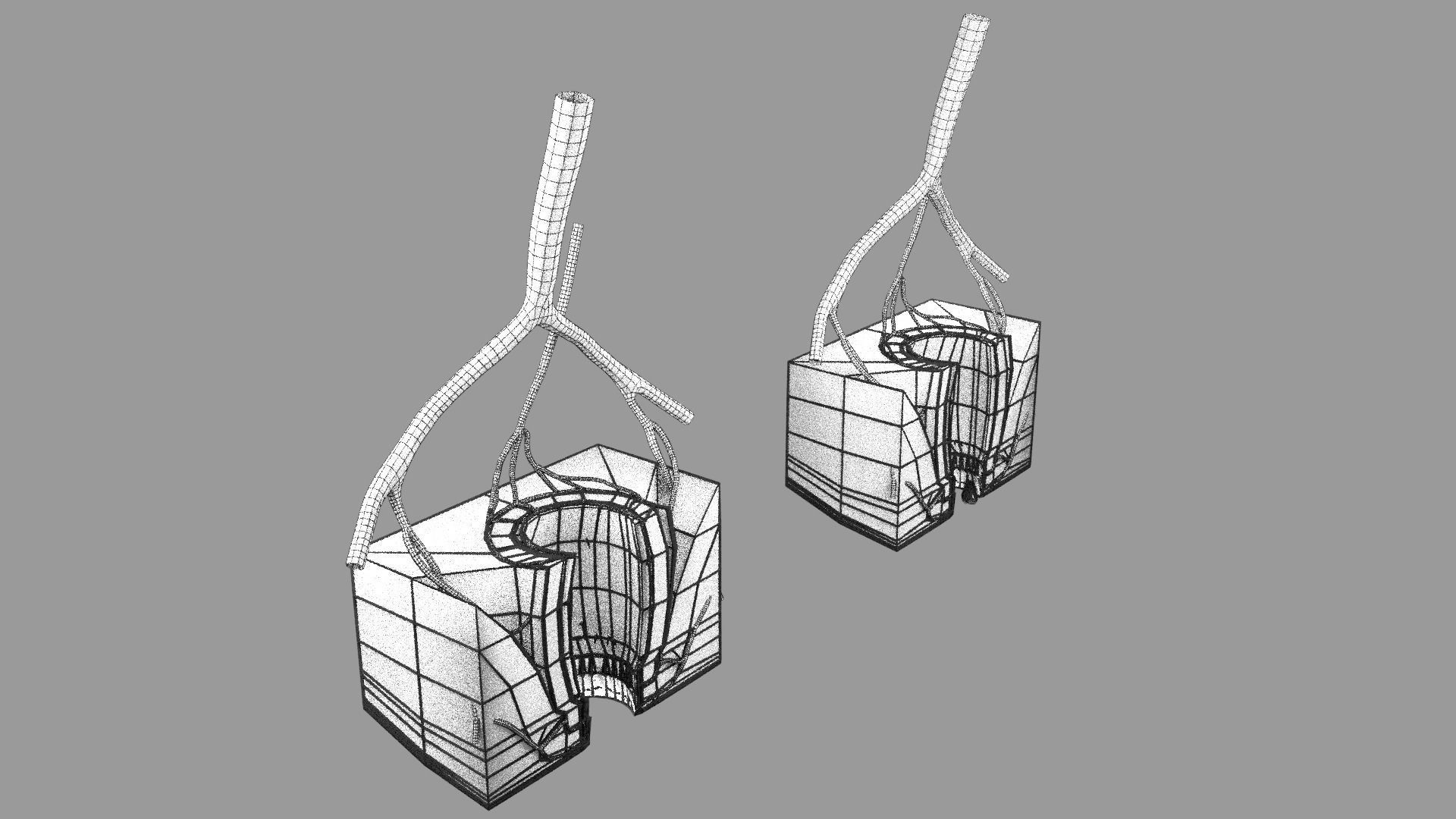 hemorrhoids piles 3D model_5