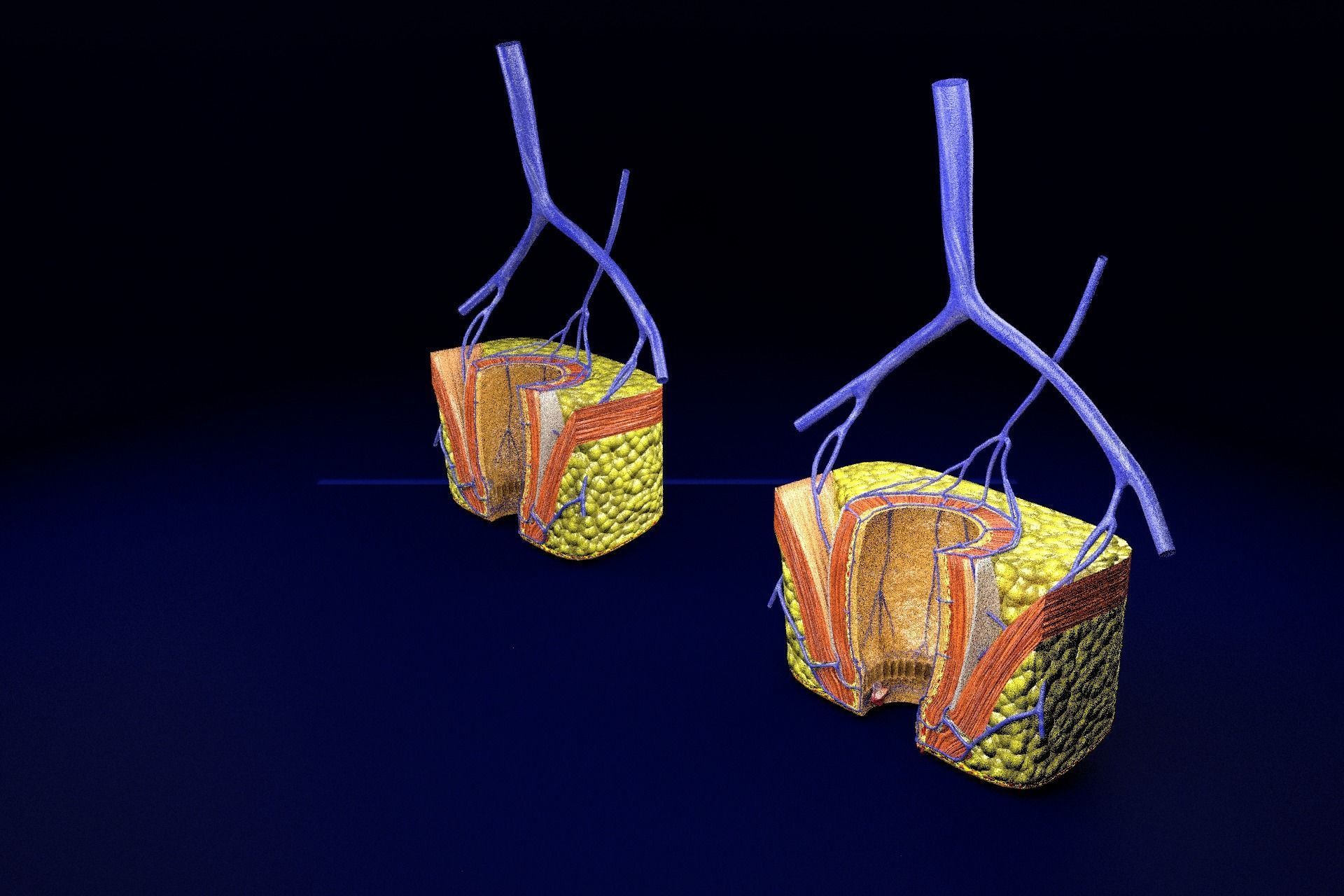 hemorrhoids piles 3D model_91