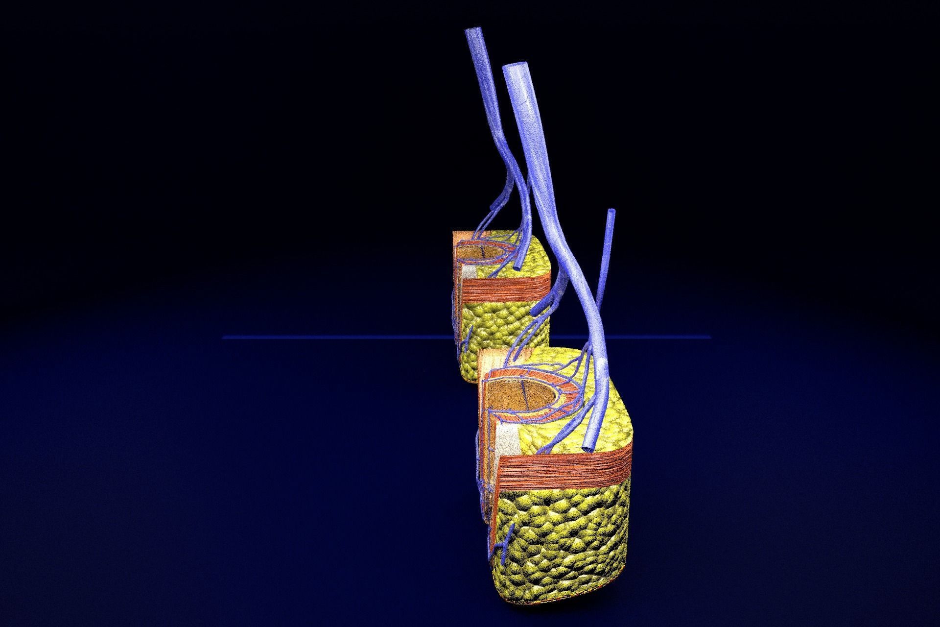 hemorrhoids piles 3D model_55