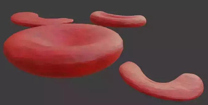 Sickle Cells