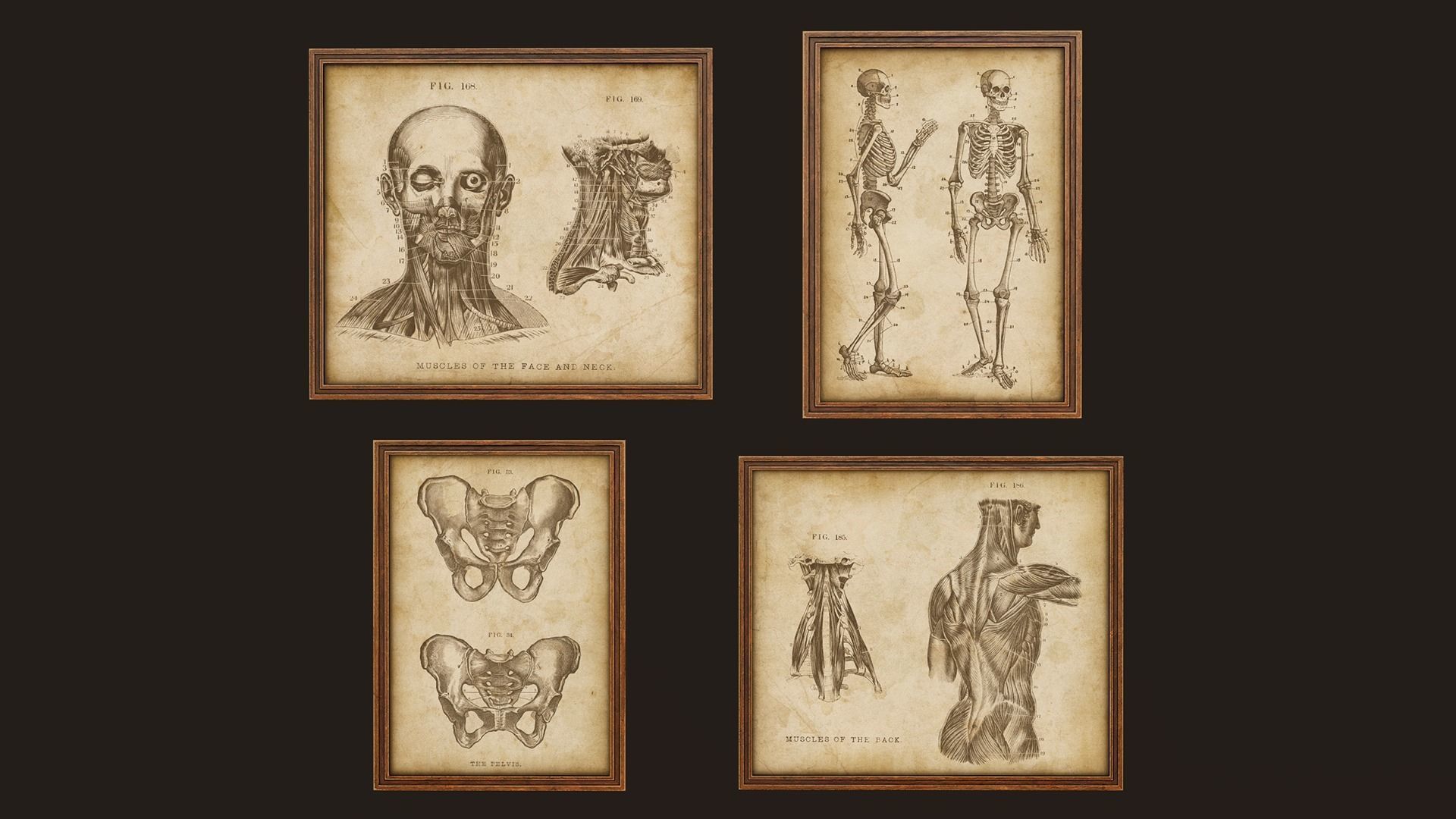 Victorian Hospital Props Pack Low-poly 3D model_12