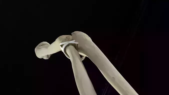 Elbow with muscles and ligaments