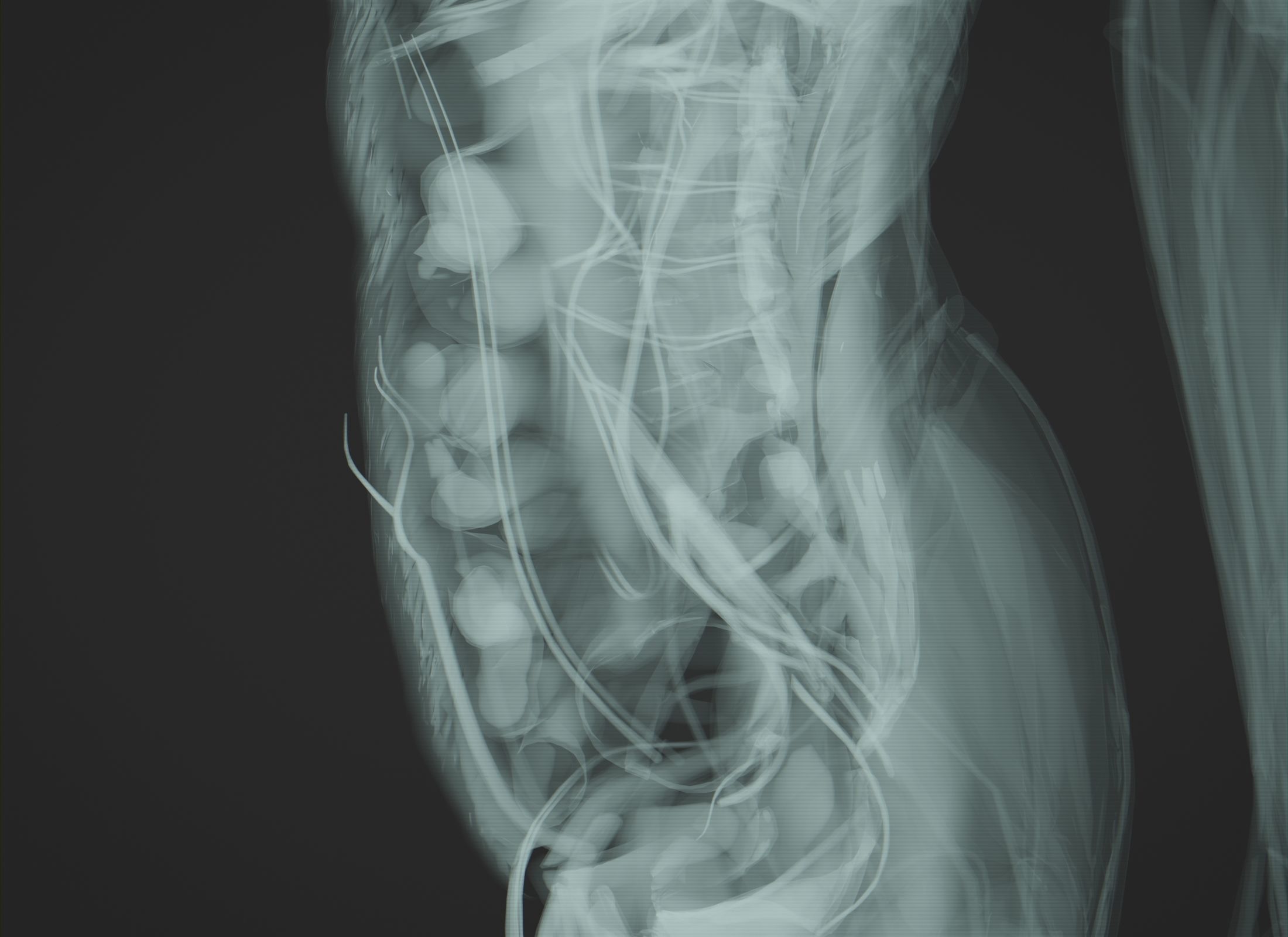 Human Anatomy Xray Animated Low-poly 3D model_3