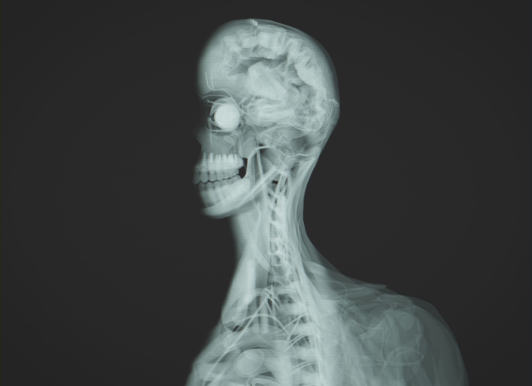 Human Anatomy Xray Animated Low-poly 3D model_9