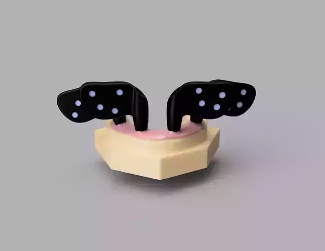 ABUTMENT IMPLANT LEVEL PIC TRANSFERS 3D print model