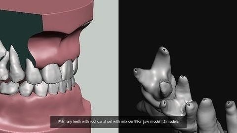 Primary teeth with root canal set with mix dentition jaw model 3D Model Collection
