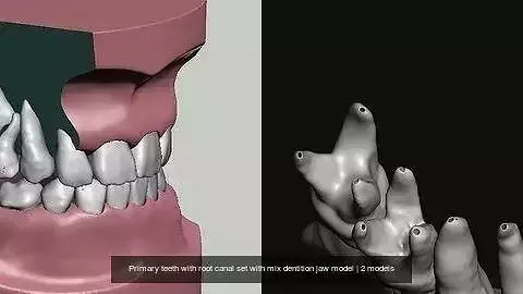 Primary teeth with root canal set with mix dentition jaw model 3D Model Collection